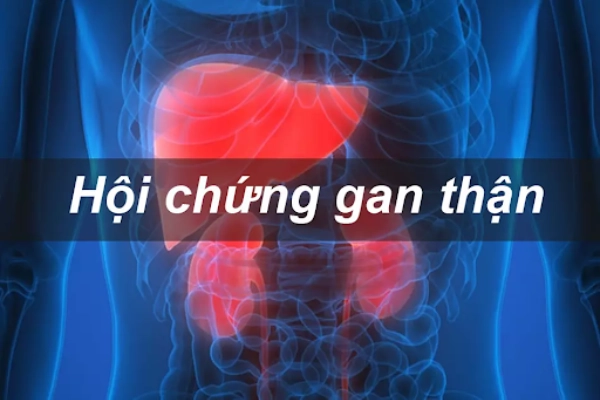 Cổ trướng gây ra hội chứng gan thận